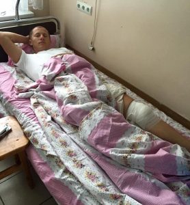 160812-Heshko-operatsia